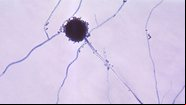 Imagem ilustrativa de fungo do gênero Aspergillus - Wikimedia Commons via Domínio Público