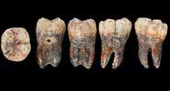 Dente de neandertal analisado - Divulgação/Instituto Max Planck