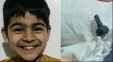 Fotografia do garoto ao lado da peça de Lego que estava em seu nariz - Divulgação /Arquivo pessoal /Mudassir Anwar