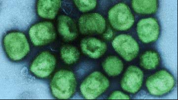 Imagem colorizada que mostra o vírus da varíola dos macacos - Instituto Nacional de Alergia e Doenças Infecciosas